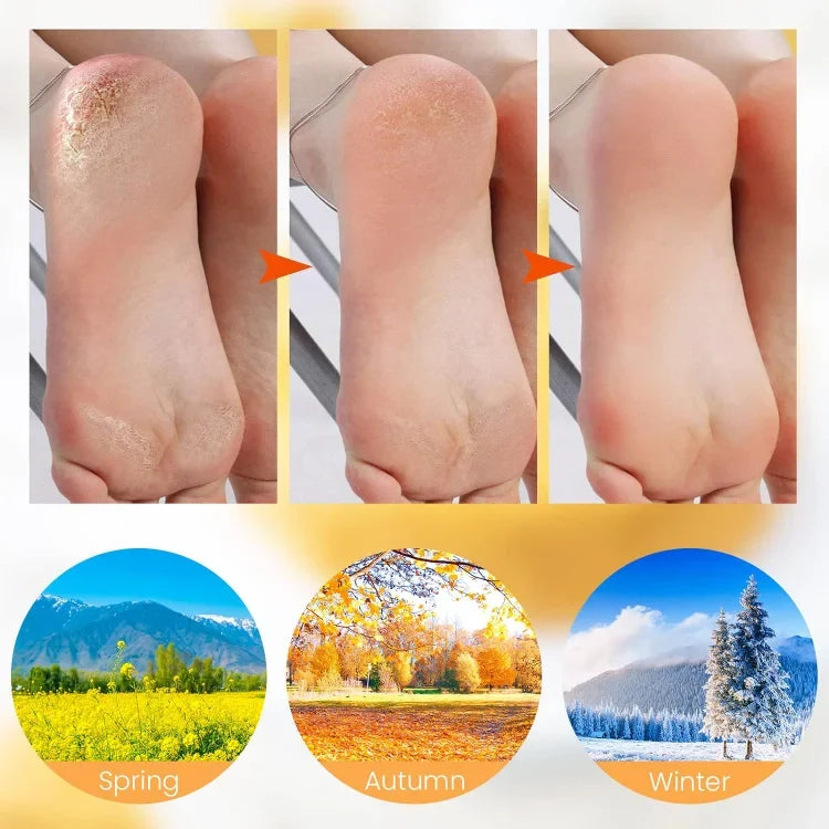 KELONDA™ Foot Skin Care Silicone Socks - GET 50% OFF