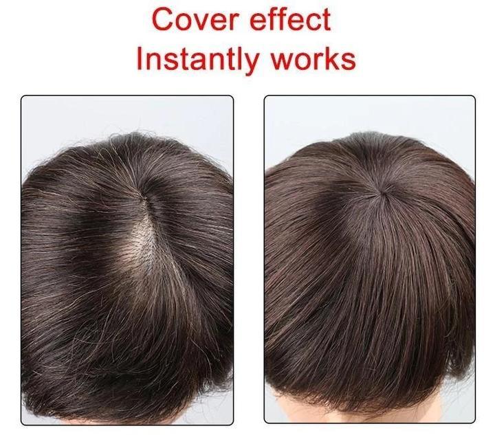 KELONDA™ Natural Human Hair Clip 150% Density | Solve the problem of hair loss!