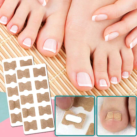 KELONDA™ | Correction patches for beautiful and healthy nails (50 PCS)