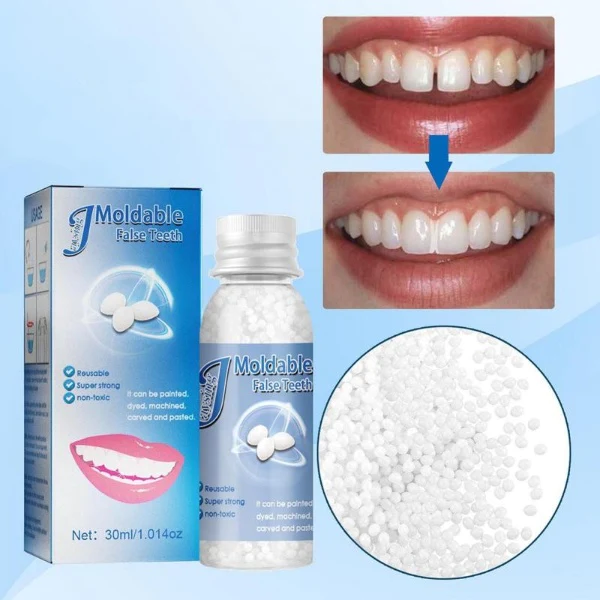 Kelonda™ DIY Tooth Repair Kit