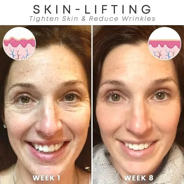 Kelonda™ Botox Face Serum