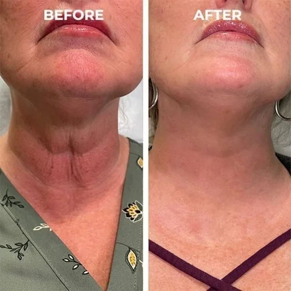Kelonda™ Botox Face Serum