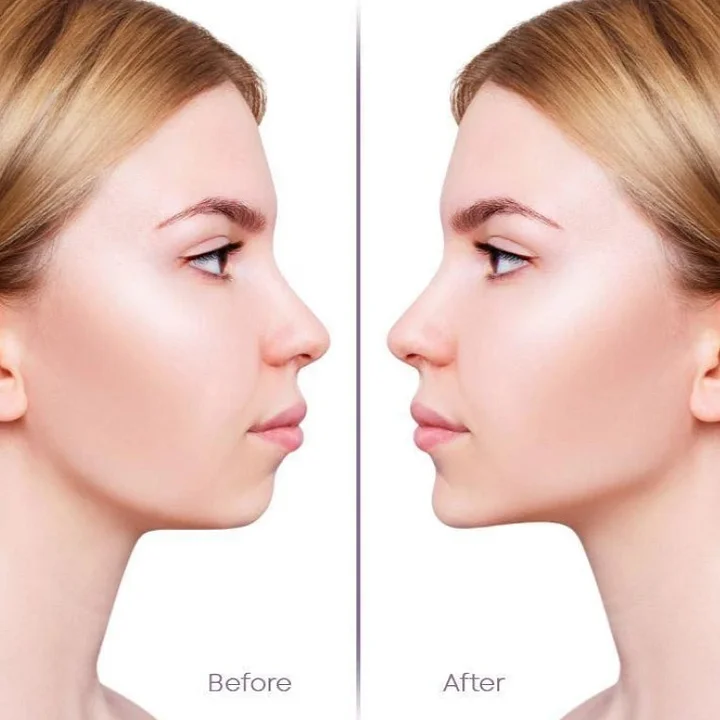 Kelonda™ Invisible Face Lifter Tape