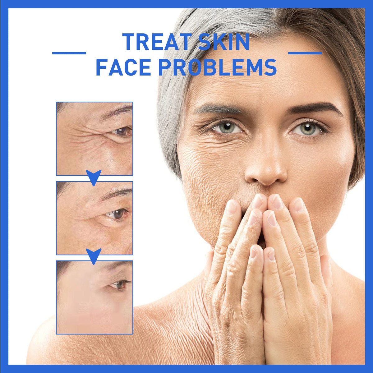 Kelonda™ Botox Face Serum