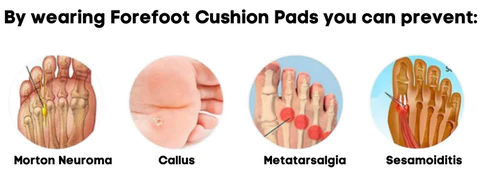KELONDA™ Forefoot Cushion Pads 2.0