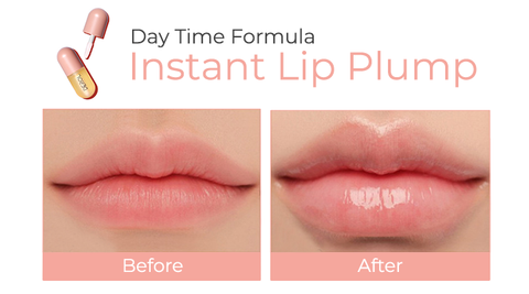 KELONDA™ Lip Plumper Kit