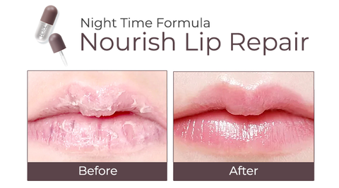 KELONDA™ Lip Plumper Kit