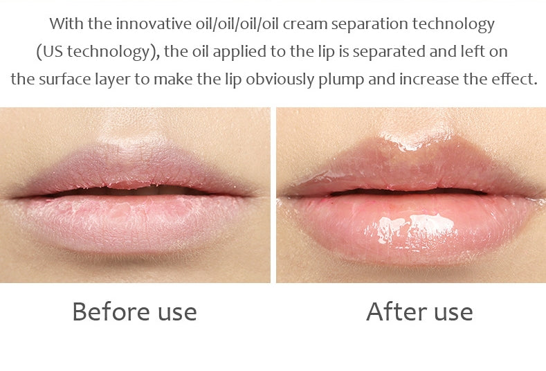 KELONDA™ Lip Maximizer - BUY 1 GET 1 FREE
