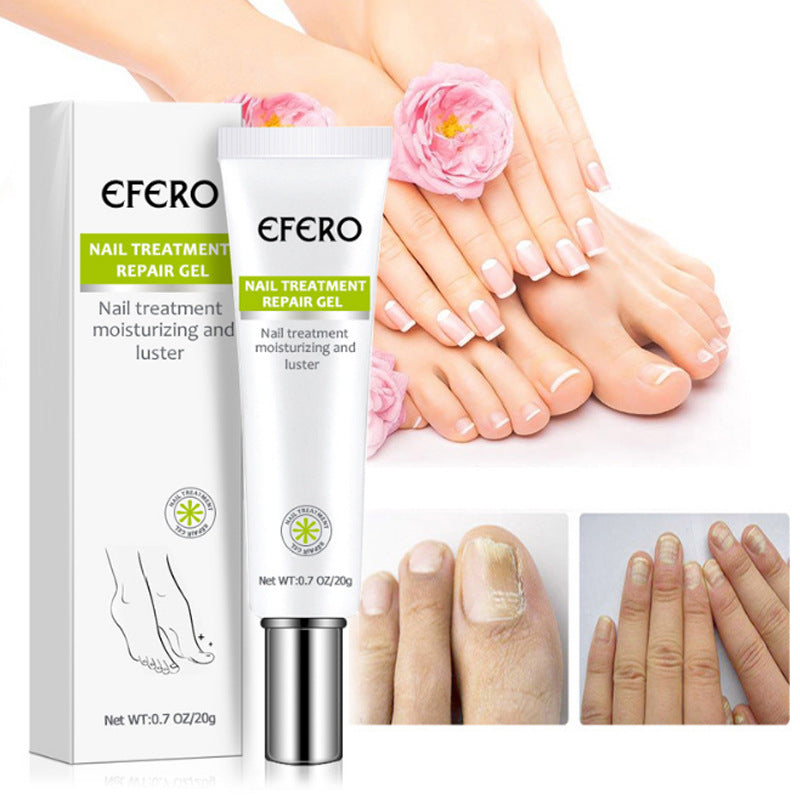 KELONDA™ Anti-Fungal Nail Repair Gel | Buy 1 Get 1 FREE