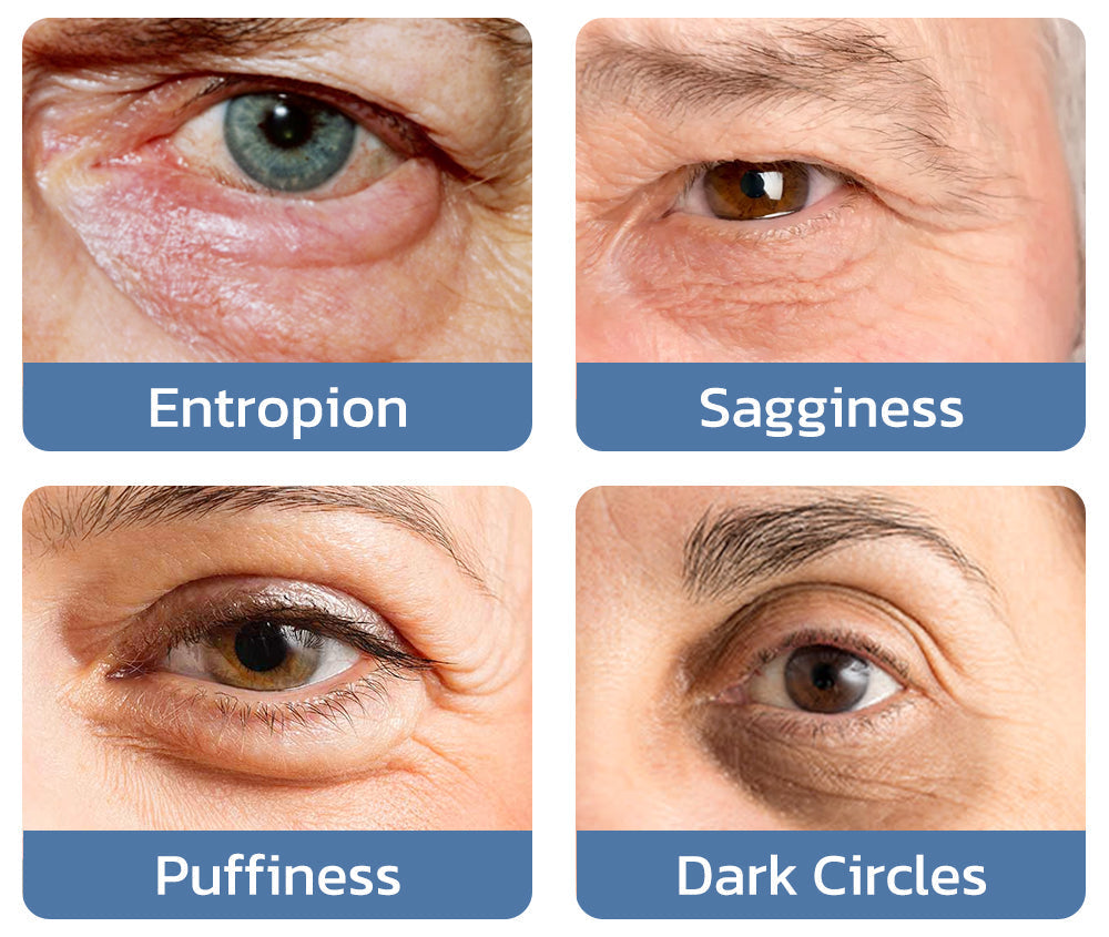 OPENEYES Awaken Peptide Lifting Eye Gel - Buy 1 Get 1 FREE