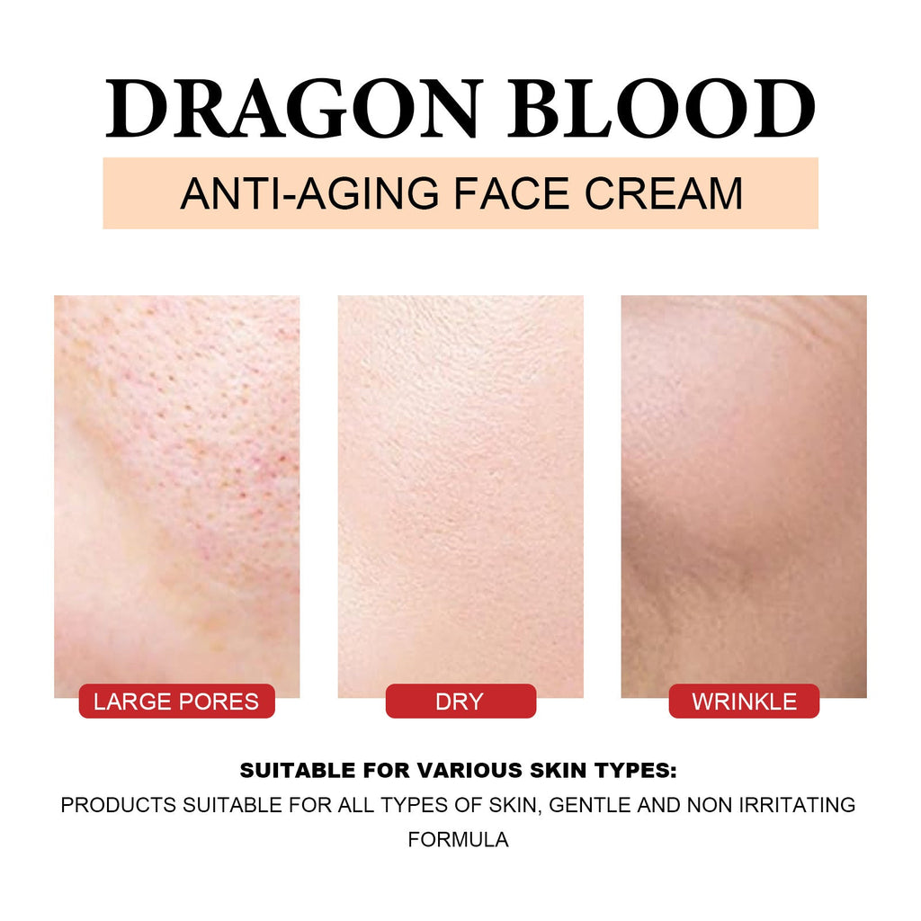 KELONDA™ Dragon Blood Moisturizing Facial Cream - BUY 1 GET 1 FREE