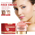 KELONDA™ Dragon Blood Moisturizing Facial Cream - BUY 1 GET 1 FREE