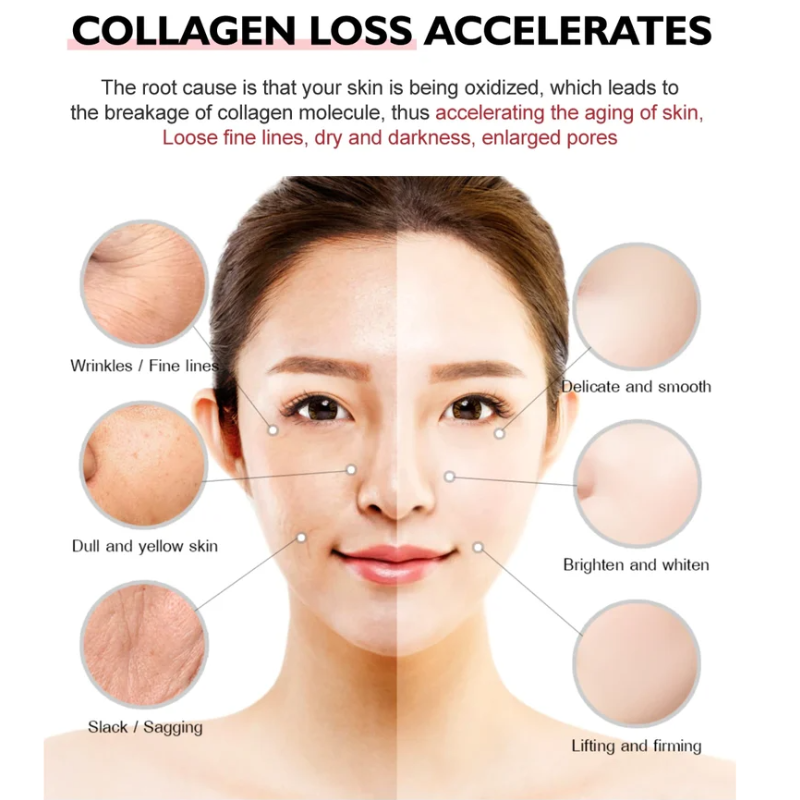 KELONDA™ SKIN WHITENING EXFOLIATING GEL | Buy 1 Get 1 Free