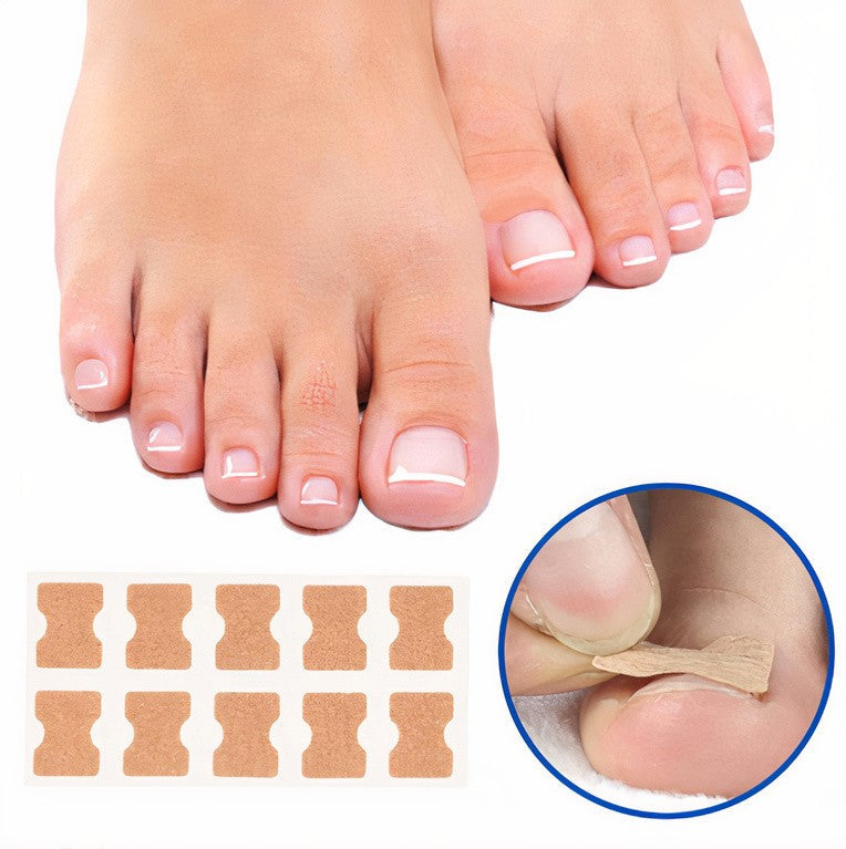 KELONDA™ | Correction patches for beautiful and healthy nails (50 PCS)