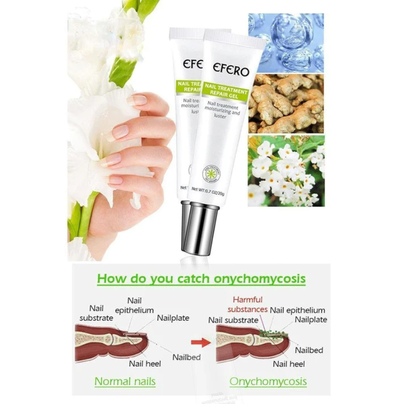 KELONDA™ Anti-Fungal Nail Repair Gel | Buy 1 Get 1 FREE