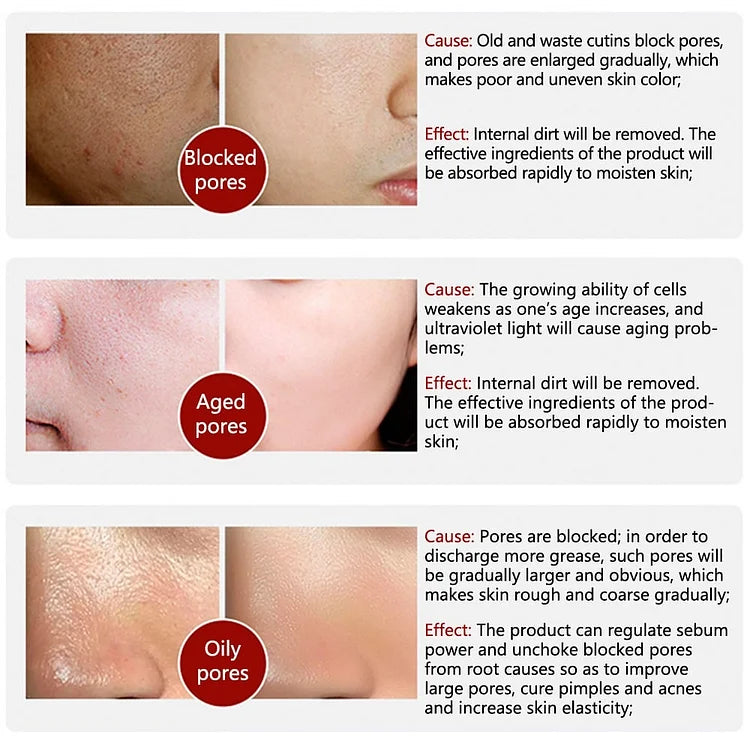 KELONDA™ Pore Primer Stick - BUY 1 GET 1 FREE