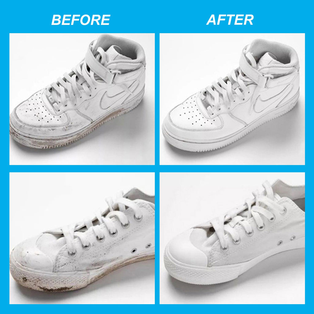 Kelonda™ Shoes Cleansing Gel Kit