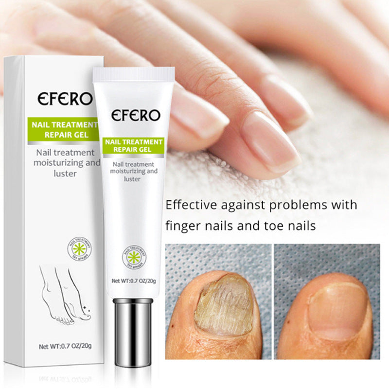 KELONDA™ Anti-Fungal Nail Repair Gel | Buy 1 Get 1 FREE