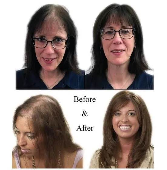 KELONDA™ Natural Human Hair Clip 150% Density | Solve the problem of hair loss!