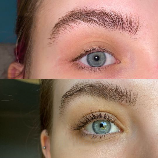 KELONDA™ Eyelash Active Serum For Longer & Fuller Lashes
