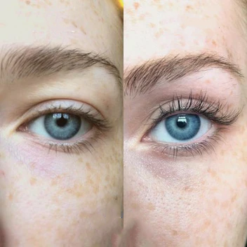 KELONDA™ Eyelash Active Serum For Longer & Fuller Lashes