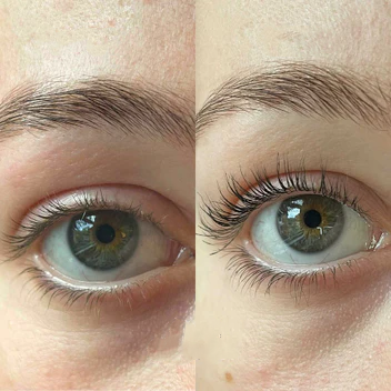 KELONDA™ Eyelash Active Serum For Longer & Fuller Lashes
