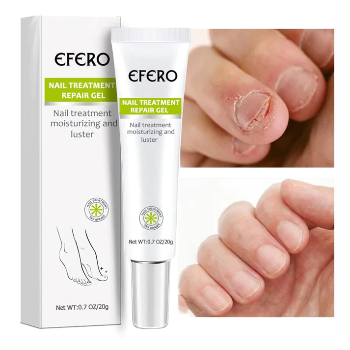 KELONDA™ Anti-Fungal Nail Repair Gel | Buy 1 Get 1 FREE