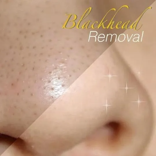 KELONDA™ Youth 24K Gold Peel-Off Mask - Buy 1 Get 1 Free