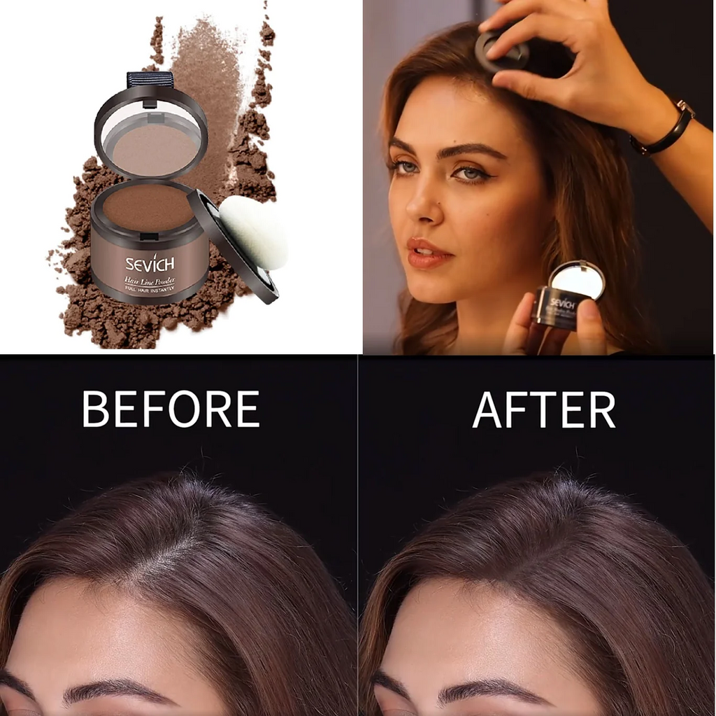 KELONDA™ Hairline Filler Powder (Unisex) - Buy 1 Get 2 FREE