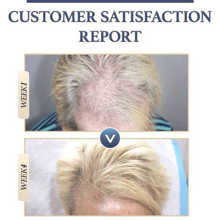 KELONDA™ Anti-Hair Loss Rice Shampoo Bar | Buy 1 Get 1 FREE