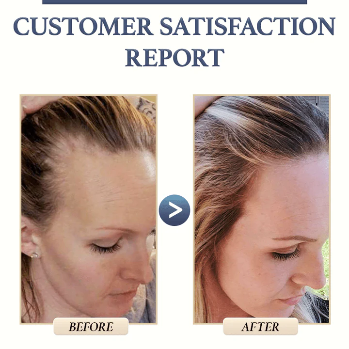 KELONDA™ Anti-Hair Loss Rice Shampoo Bar | Buy 1 Get 1 FREE