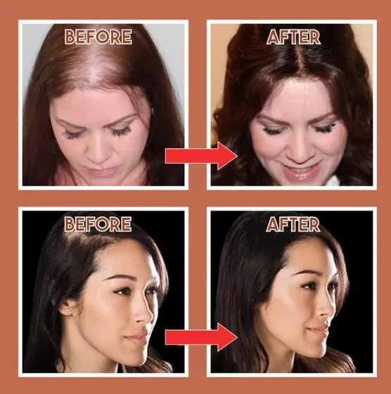 KELONDA™ Natural Human Hair Clip 150% Density | Solve the problem of hair loss!