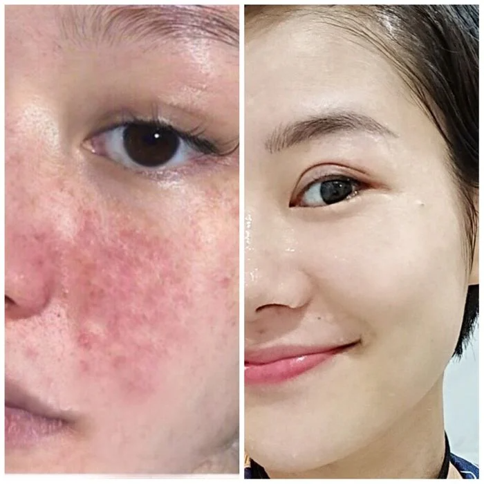 KELONDA™ SKIN WHITENING EXFOLIATING GEL | Buy 1 Get 1 Free
