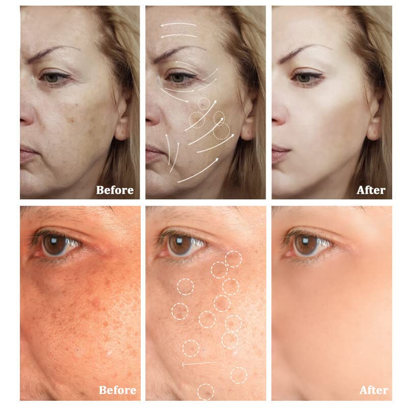 KELONDA™ Korean Collagen Firming Mask