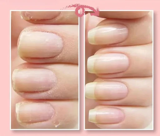 KELONDA™ Nail Repair Extend Fiber Gel | Buy 1 Get 1 FREE
