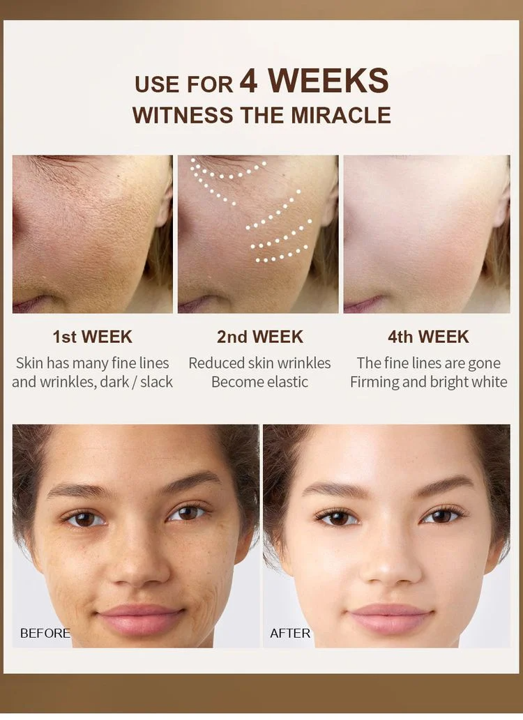 KELONDA™ SKIN WHITENING EXFOLIATING GEL | Buy 1 Get 1 Free