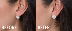 KELONDA™ Earring Lifters for Stretched Earlobes