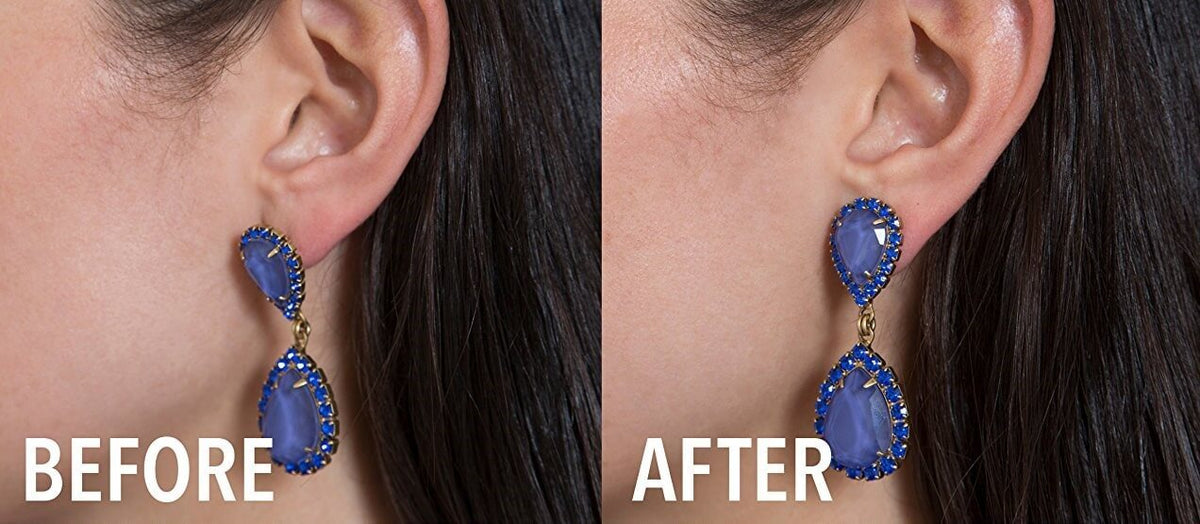 KELONDA™ Earring Lifters for Stretched Earlobes
